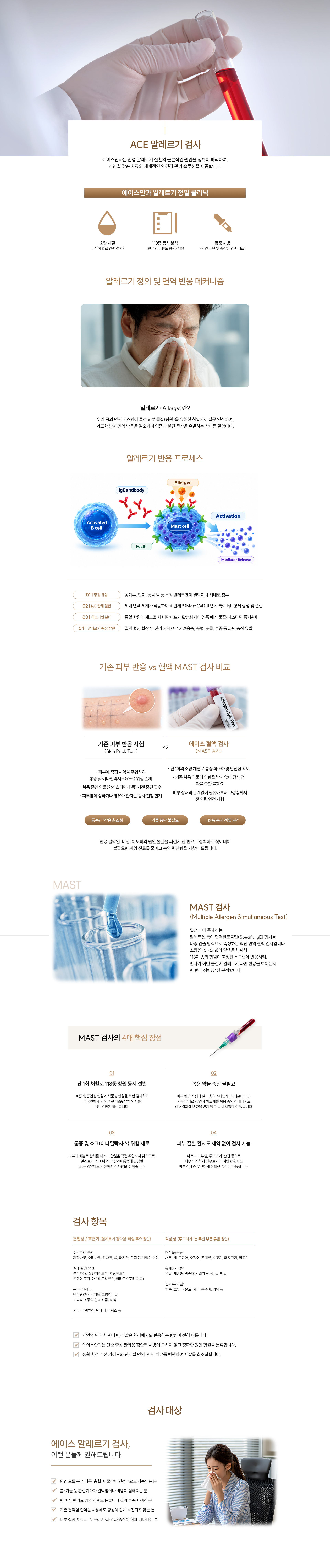 알레르기 검사