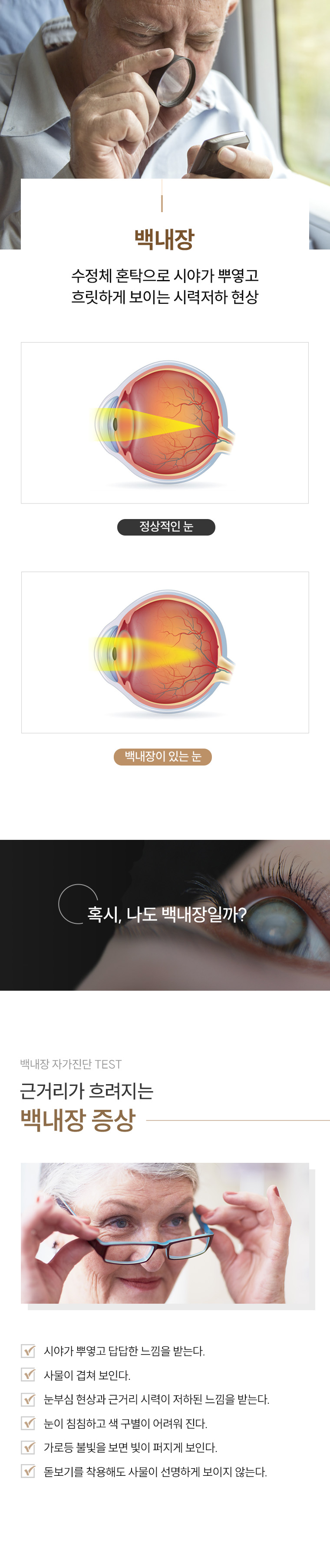 백내장이란