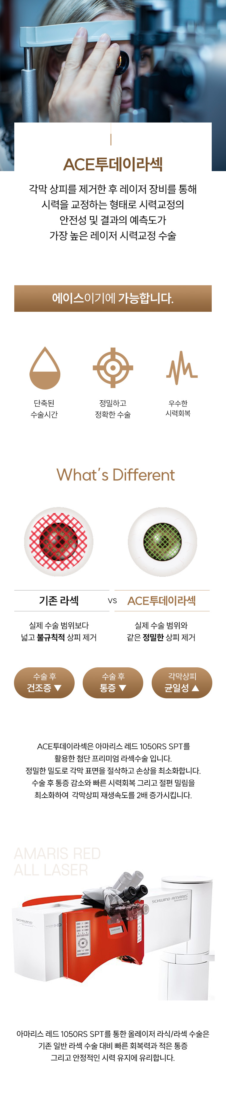 에이스 라섹