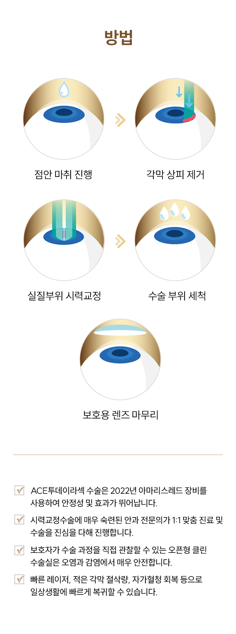 에이스 라섹