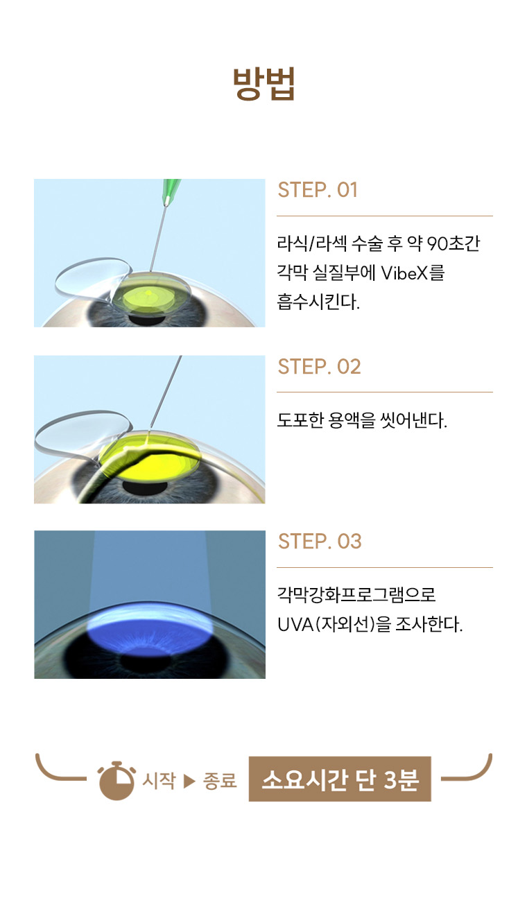 각막강화술