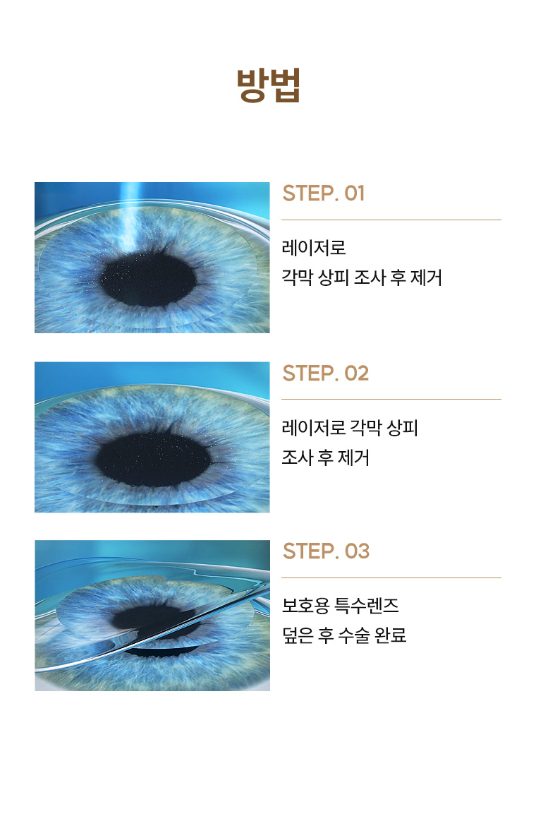 투데이라섹