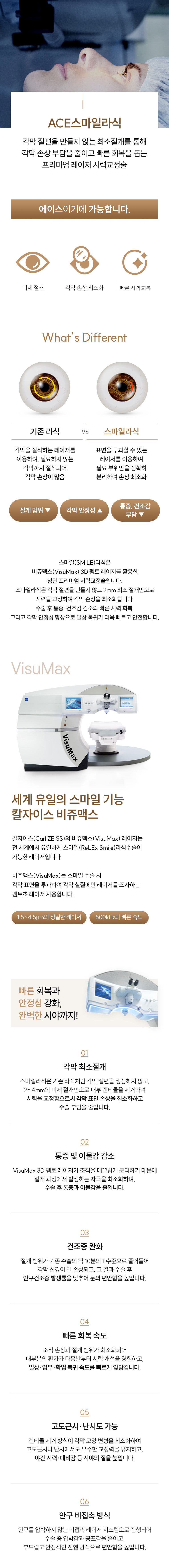 스마일라식