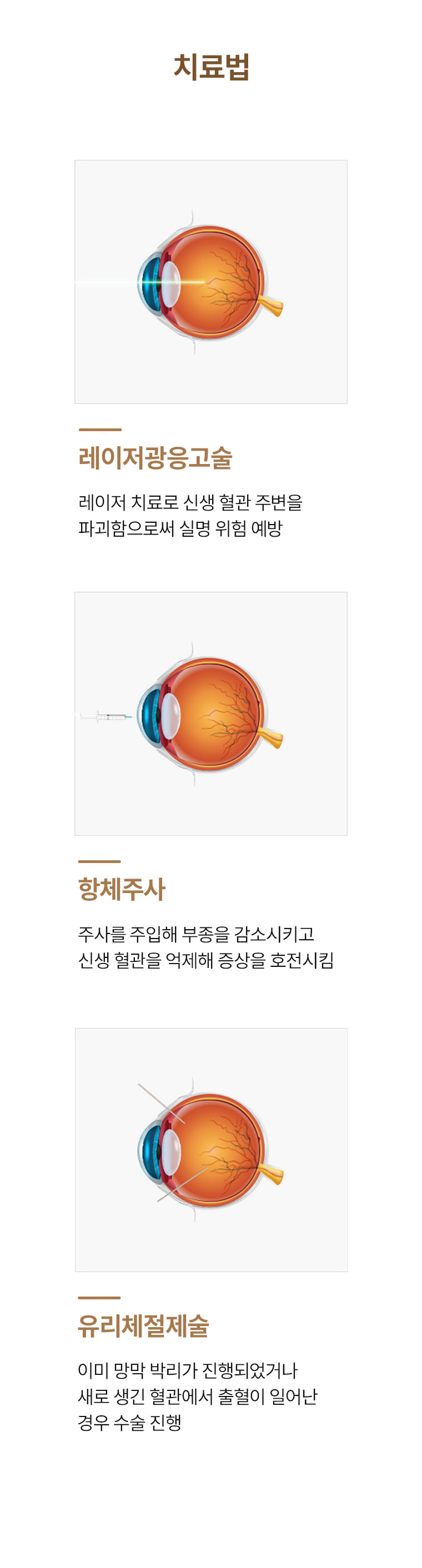 당뇨망막병증