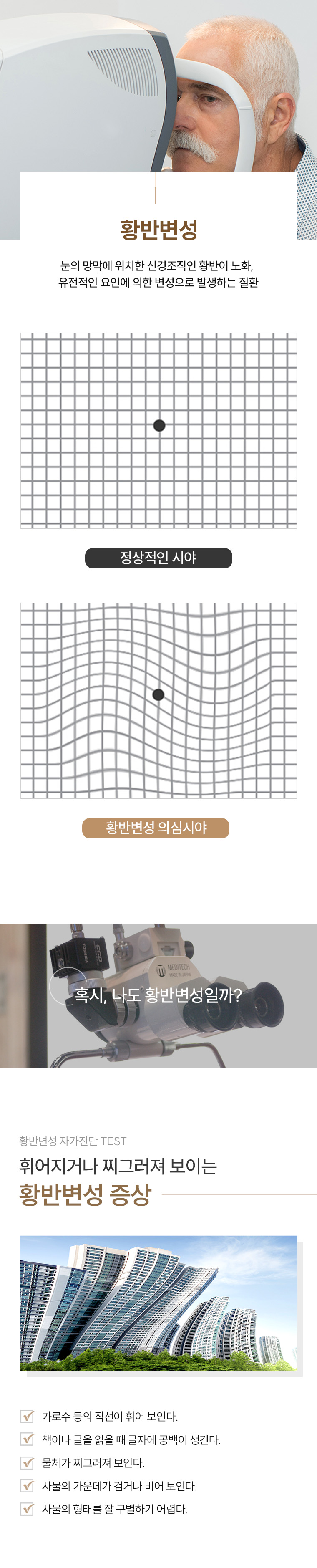 황반변성