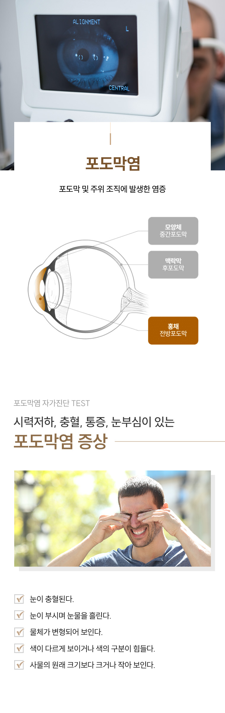 포도막엽