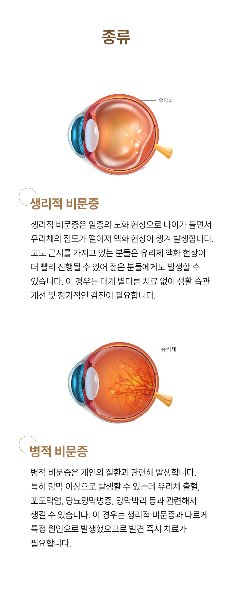 비문증