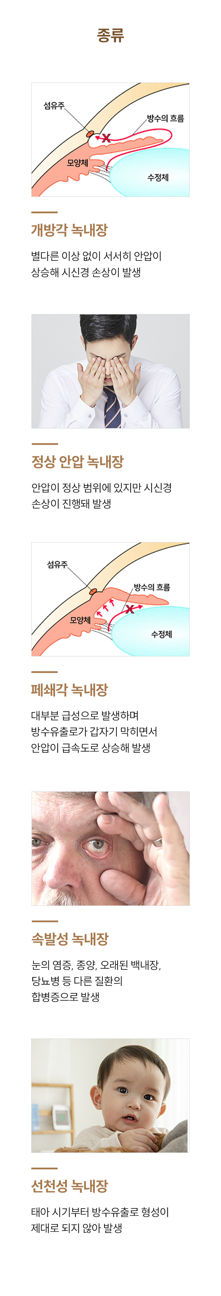 녹내장