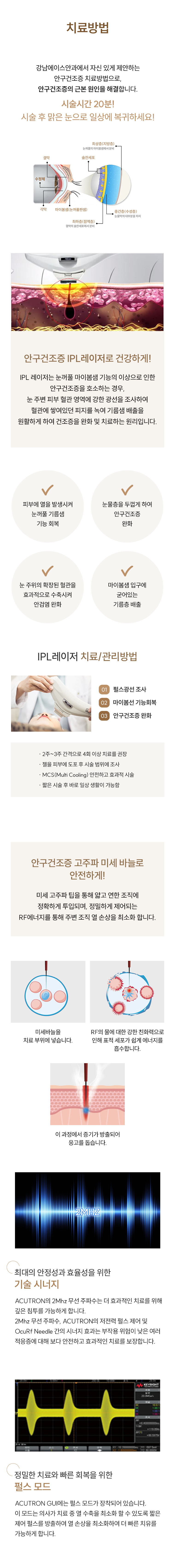 안구건조증