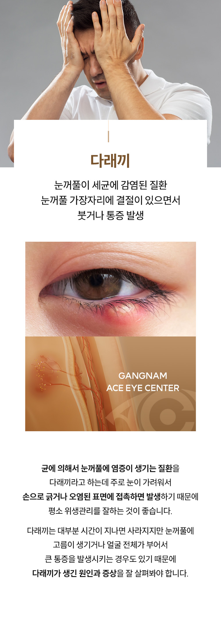 다래끼